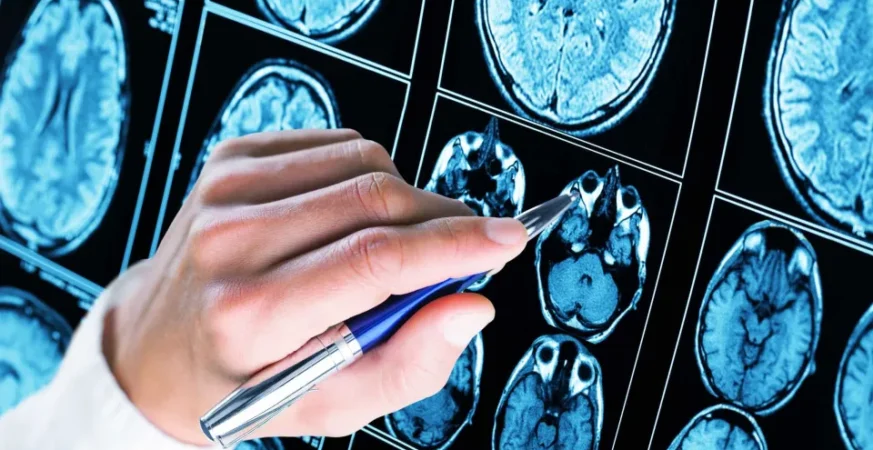 Mais de 50% dos diagnósticos de autismo ocorrem antes dos 5 anos de idade