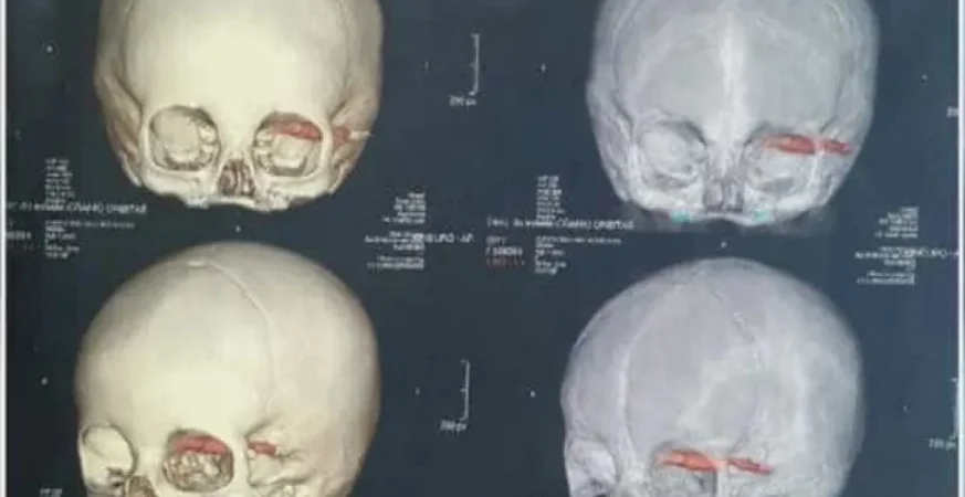 Cientistas acham crânios de 2.000 anos, e detalhe nos dentes chama atenção