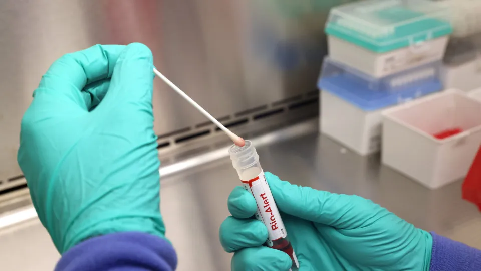 Casos de mpox mais que dobram em 20 dias, com 129 confirmações no Brasil