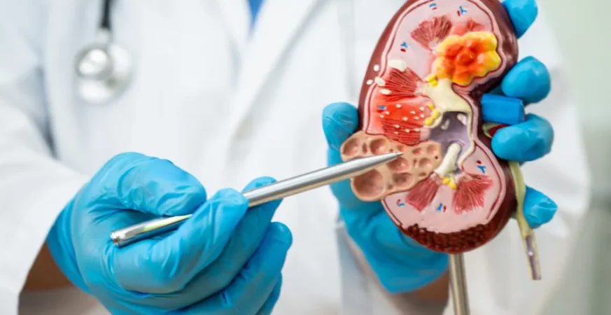 Doença renal avança no país e expõe gargalos de acesso à diagnóstico precoce e à diálise