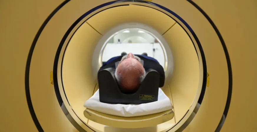 Alzheimer é a segunda doença mais temida pelos brasileiros, atrás apenas do câncer