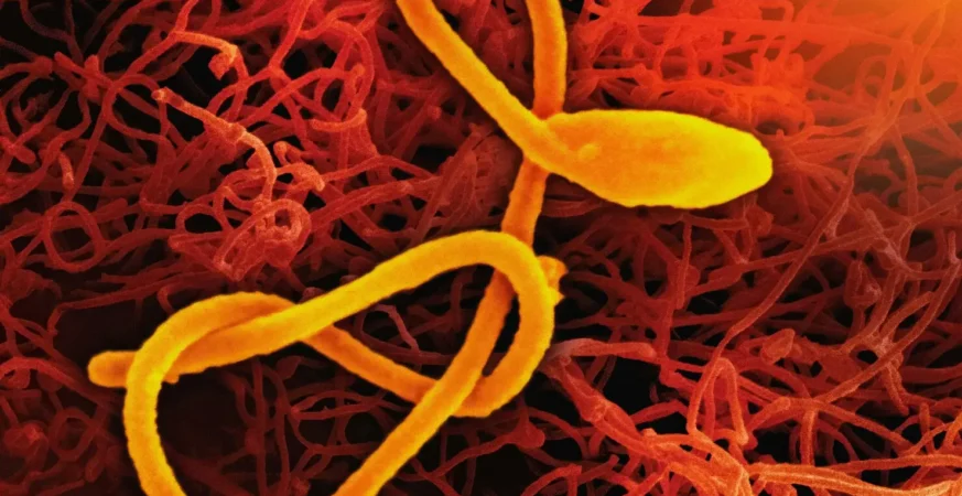 ebola