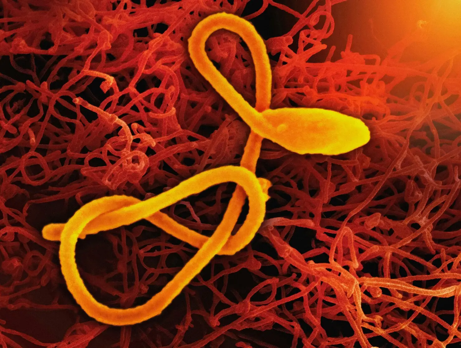 ebola