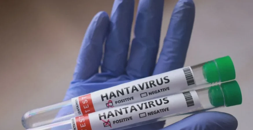 hantavirus amostrar 4 e1778184374651