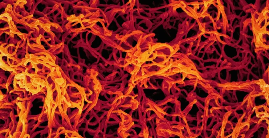 ebola