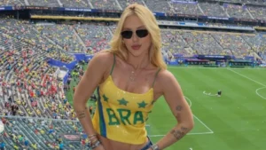Celebridades que sofrem de alopecia e podem ficar carecas